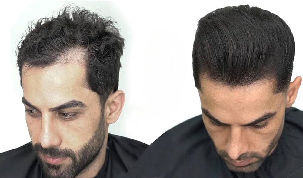 ألياف بناء وتكثيف الشعر الرقيق والناعم للرجال والنساء