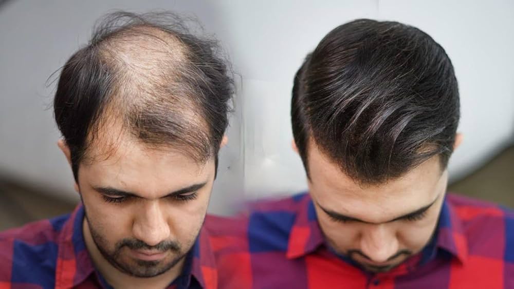 ألياف بناء وتكثيف الشعر الرقيق والناعم للرجال والنساء